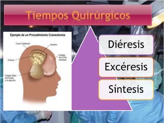 Diéresis
Excéresis
Síntesis
 