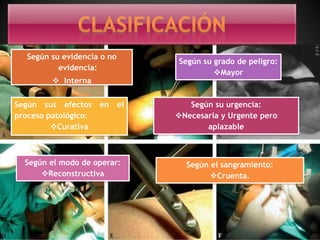 Según su evidencia o no
evidencia:
 Interna
Según su grado de peligro:
Mayor
Según sus efectos en el
proceso patológico:
Curativa
Según el modo de operar:
Reconstructiva
Según su urgencia:
Necesaria y Urgente pero
aplazable
Según el sangramiento:
Cruenta.
 
