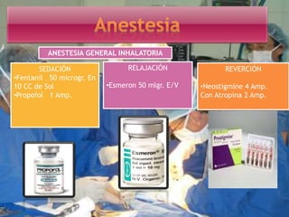 ANESTESIA GENERAL INHALATORIA
SEDACIÓN
•Fentanil 50 microgr. En
10 CC de Sol
•Propofol 1 Amp.
REVERCIÓN
•Neostigmine 4 Amp.
Con Atropina 2 Amp.
RELAJACIÓN
•Esmeron 50 mlgr. E/V
 
