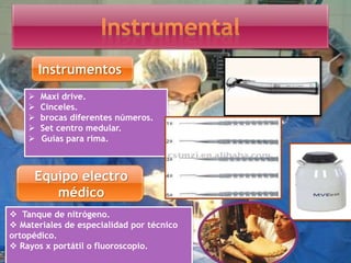 Instrumentos
 Maxi drive.
 Cinceles.
 brocas diferentes números.
 Set centro medular.
 Guías para rima.
Equipo electro
médico
 Tanque de nitrógeno.
 Materiales de especialidad por técnico
ortopédico.
 Rayos x portátil o fluoroscopio.
 