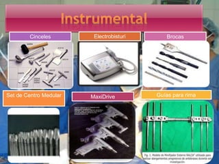 BrocasCinceles
Guías para rimaSet de Centro Medular MaxiDrive
Electrobisturi
 