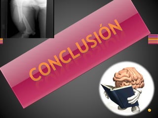 Craneotomia y Osteosintesis