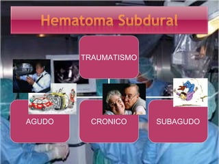 TRAUMATISMO
AGUDO CRONICO SUBAGUDO
 