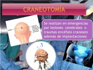 Se realizan en emergencias
por lesiones cerebrales o
traumas encéfalo craneano
además de implantaciones
 