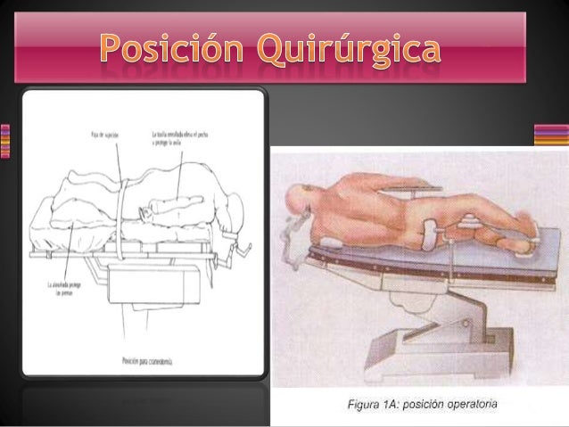 Si es posible dejar fumar bajo la hipnosis