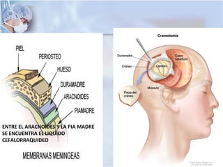 ENTRE EL ARACNOIDES Y LA PIA MADRE
SE ENCUENTRA EL LIQUIDO
CEFALORRAQUIDEO
 