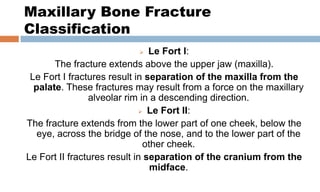 Fort Classification Cranial and facial fractures | PPTX