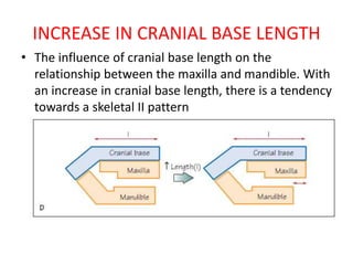 INCREASE IN CRANIAL BASE LENGTH
• The influence of cranial base length on the
relationship between the maxilla and mandible. With
an increase in cranial base length, there is a tendency
towards a skeletal II pattern
 