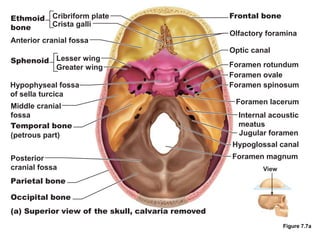 Anatomy of cranial base
Figure 7.7a
Hypophyseal fossa
of sella turcica
Middle cranial
fossa
Temporal bone
(petrous part)
Posterior
cranial fossa
Parietal bone
Occipital bone
Foramen magnum
(a) Superior view of the skull, calvaria removed
Frontal bone
Olfactory foramina
Optic canal
Foramen rotundum
Foramen ovale
Foramen spinosum
Jugular foramen
Hypoglossal canal
Foramen lacerum
Internal acoustic
meatus
Cribriform plateEthmoid
bone Crista galli
Sphenoid
Anterior cranial fossa
Lesser wing
Greater wing
View
 
