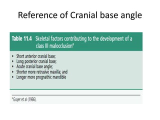 Reference of Cranial base angle
 