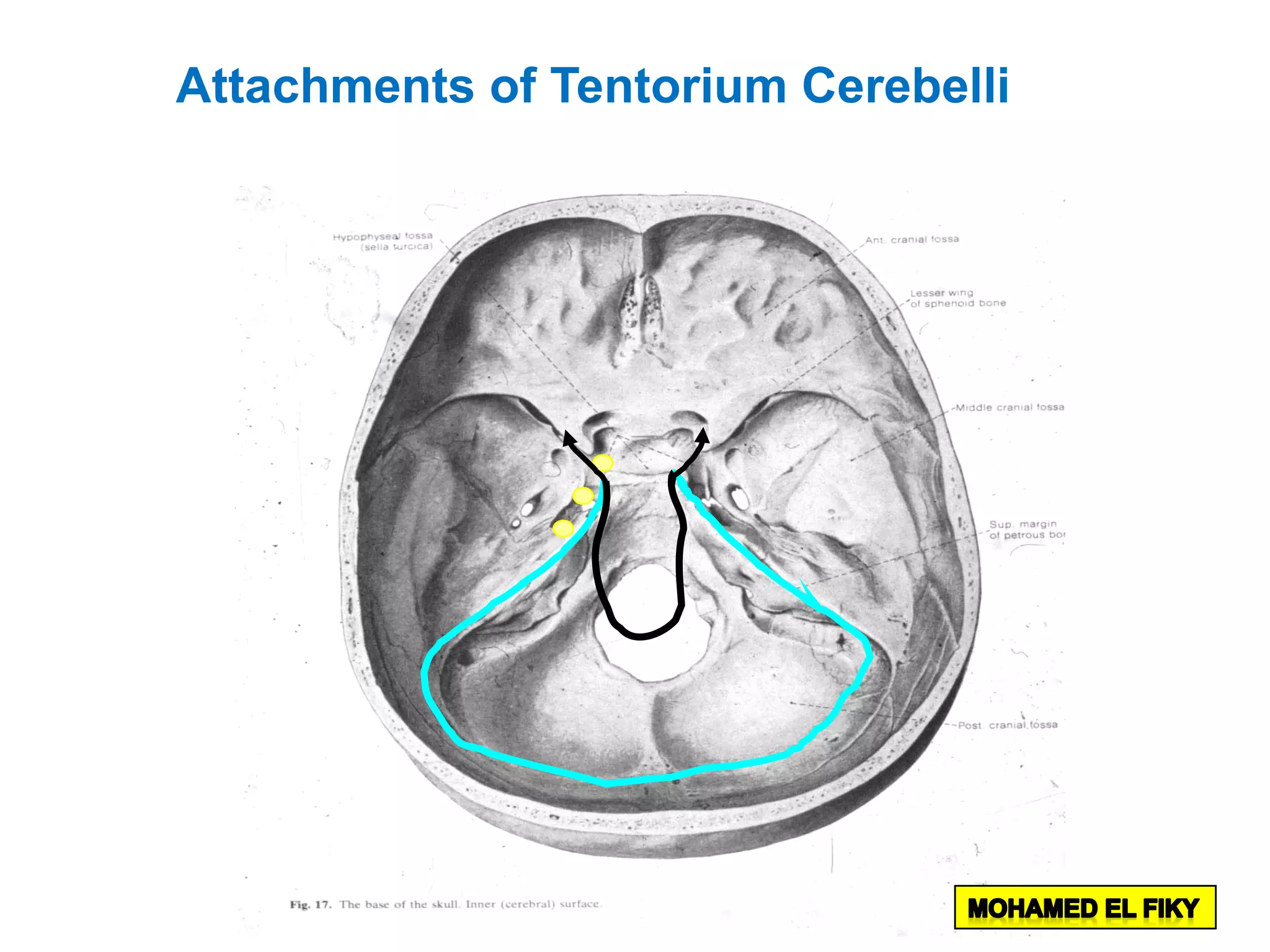 Attachments of Tentorium Cerebelli
 