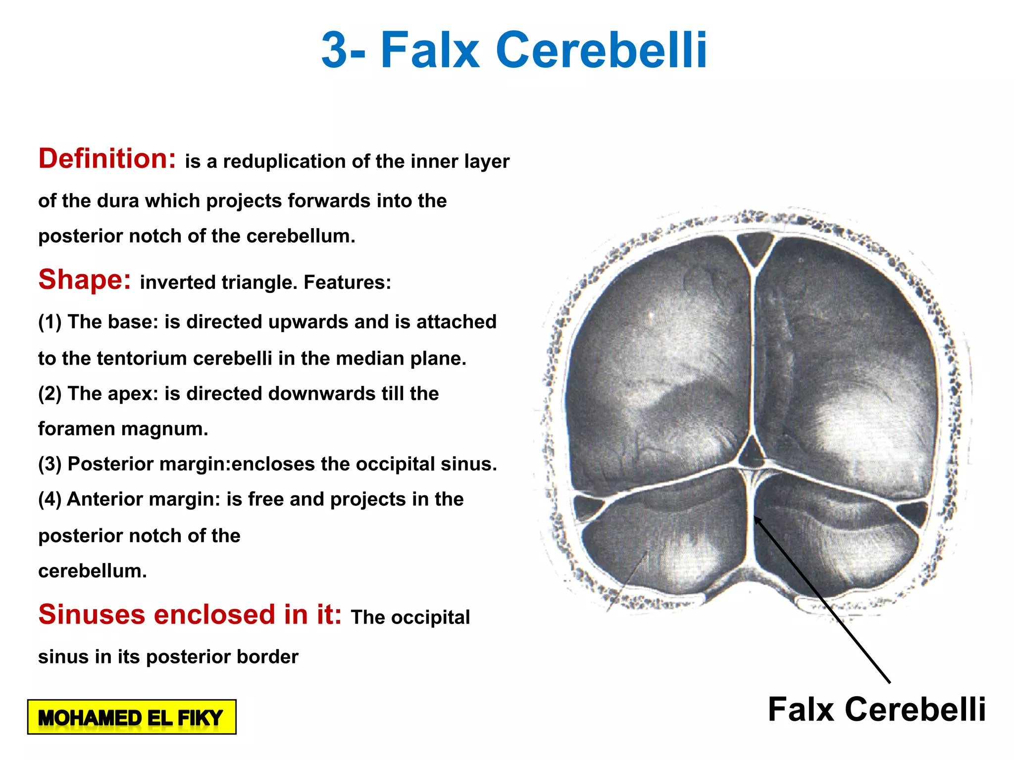 3- Falx Cerebelli
Definition: is a reduplication of the inner layer
of the dura which projects forwards into the
posterior notch of the cerebellum.
Shape: inverted triangle. Features:
(1) The base: is directed upwards and is attached
to the tentorium cerebelli in the median plane.
(2) The apex: is directed downwards till the
foramen magnum.
(3) Posterior margin:encloses the occipital sinus.
(4) Anterior margin: is free and projects in the
posterior notch of the
cerebellum.
Sinuses enclosed in it: The occipital
sinus in its posterior border
Falx Cerebelli
 