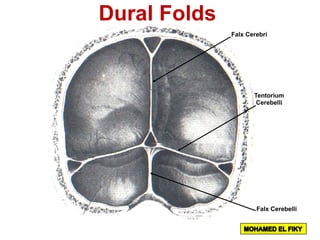 Falx Cerebri
Falx Cerebelli
Tentorium
Cerebelli
Dural Folds
 