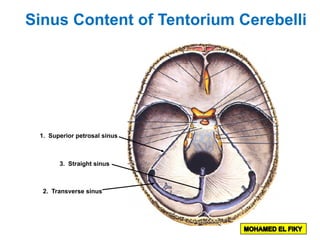 1. Superior petrosal sinus
2. Transverse sinus
3. Straight sinus
Sinus Content of Tentorium Cerebelli
 