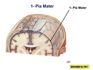 1- Pia Mater1- Pia Mater
 
