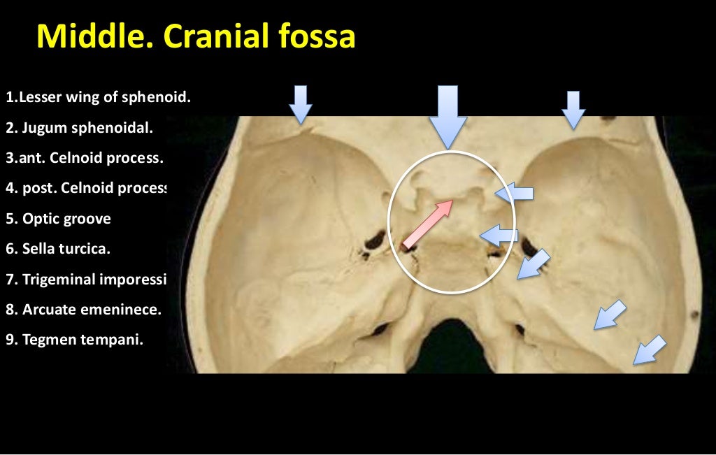 Cranial cavity + skull cap