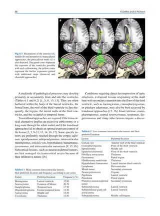 Transbasal Approach Cranial, craniofacial and skull base surgery uploaded for egypt orl-hns ...
