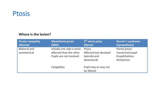 Ptosis
 