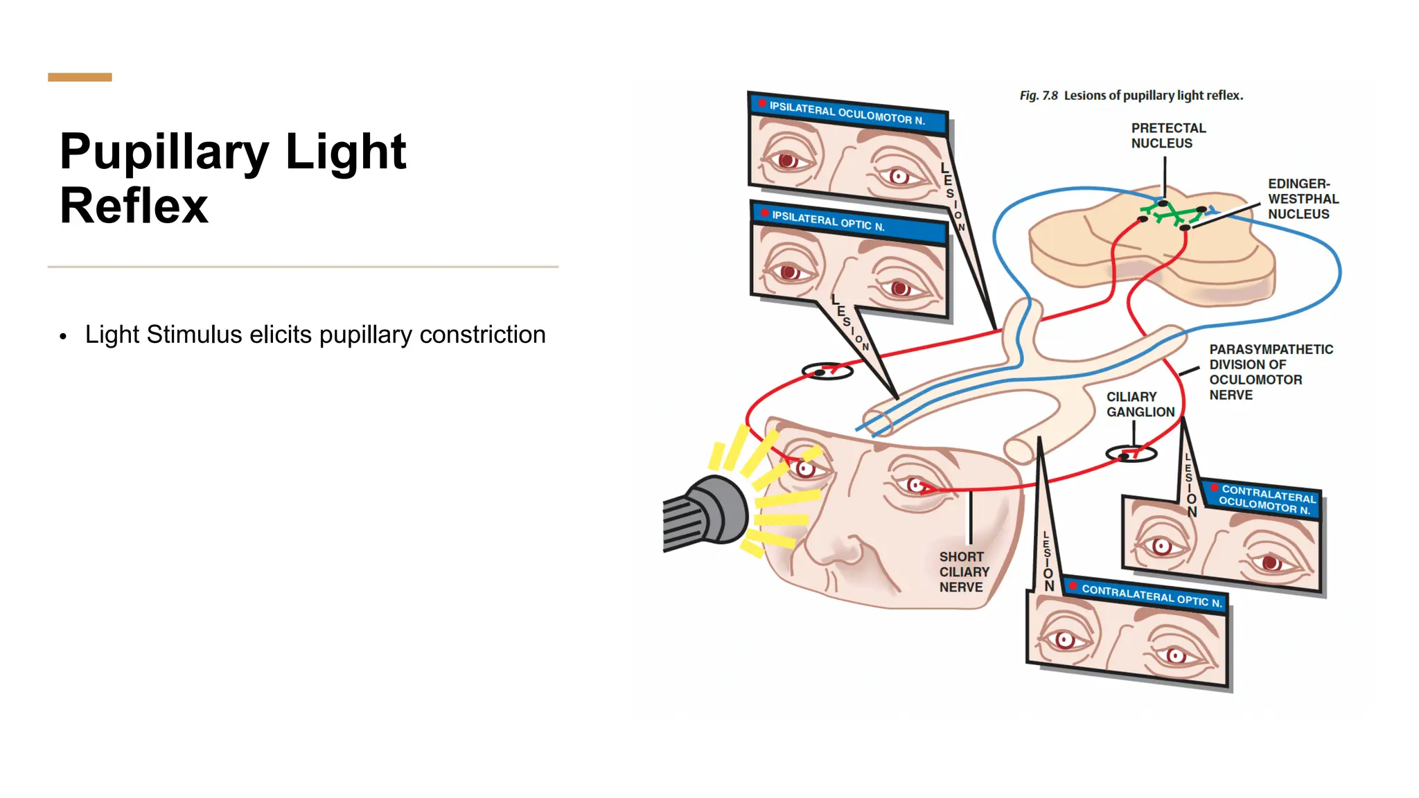 Pupillary Light
Reflex
• Light Stimulus elicits pupillary constriction
 