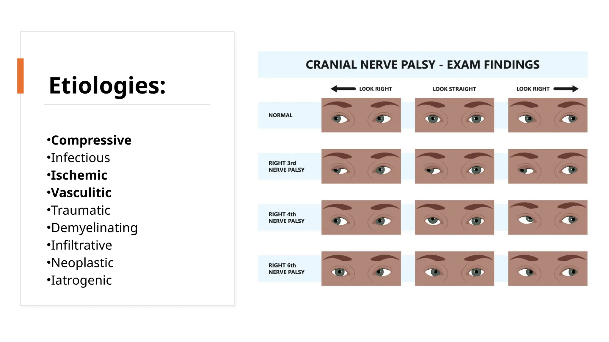 •Compressive
•Infectious
•Ischemic
•Vasculitic
•Traumatic
•Demyelinating
•Infiltrative
•Neoplastic
•Iatrogenic
Etiologies:
 