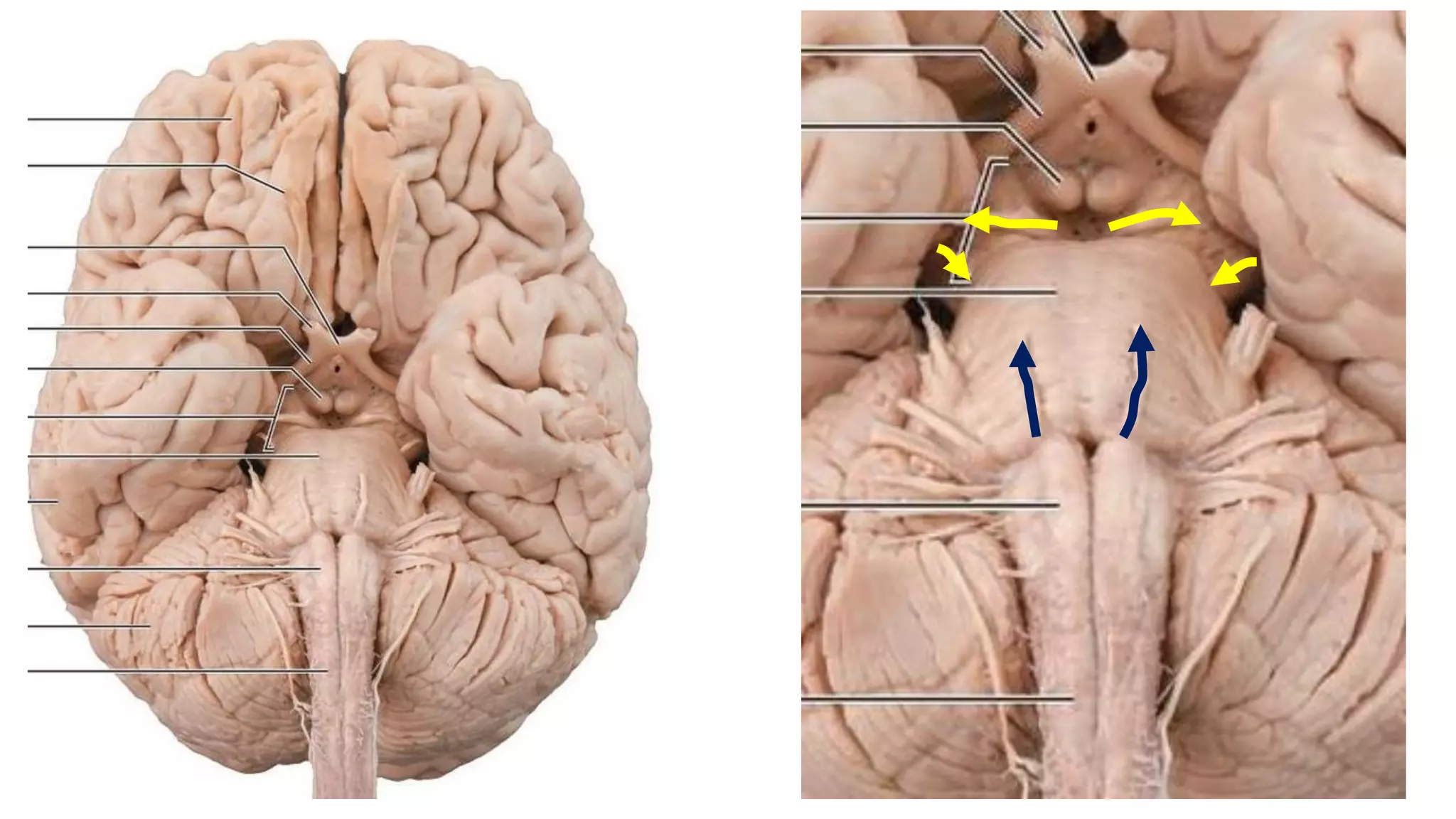 Cranial nerve III, IV and VI | PDF