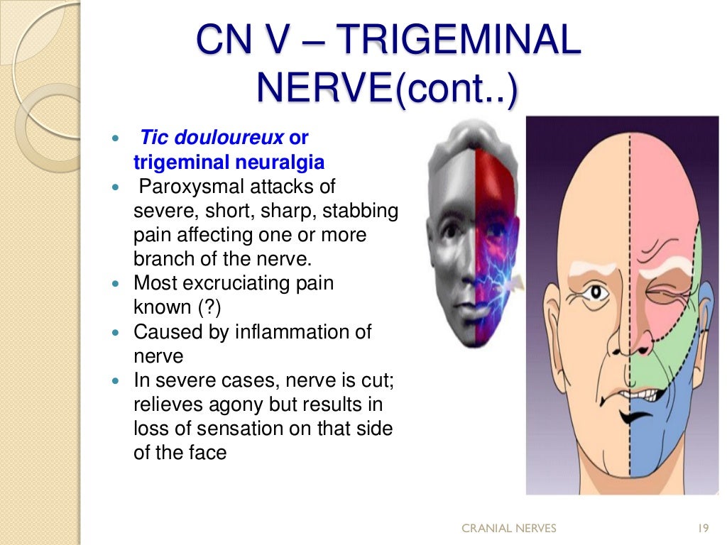 Cranial nerve assessment..Simple and Easy to perform for medics and P…