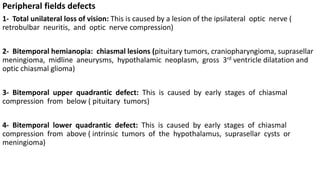 Peripheral fields defects
1- Total unilateral loss of vision: This is caused by a lesion of the ipsilateral optic nerve (
retrobulbar neuritis, and optic nerve compression)
2- Bitemporal hemianopia: chiasmal lesions (pituitary tumors, craniopharyngioma, suprasellar
meningioma, midline aneurysms, hypothalamic neoplasm, gross 3rd ventricle dilatation and
optic chiasmal glioma)
3- Bitemporal upper quadrantic defect: This is caused by early stages of chiasmal
compression from below ( pituitary tumors)
4- Bitemporal lower quadrantic defect: This is caused by early stages of chiasmal
compression from above ( intrinsic tumors of the hypothalamus, suprasellar cysts or
meningioma)
 