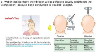 b- Weber test: Normally, the vibration will be perceived equally in both ears (no
lateralization) because bone conduction is equaled bilateral.
 