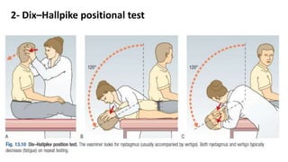 2- Dix–Hallpike positional test
 
