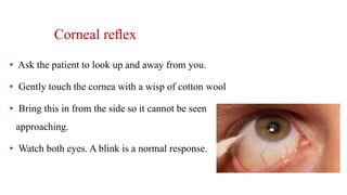 Corneal reﬂex
• Ask the patient to look up and away from you.
• Gently touch the cornea with a wisp of cotton wool
• Bring this in from the side so it cannot be seen
approaching.
• Watch both eyes. A blink is a normal response.
 