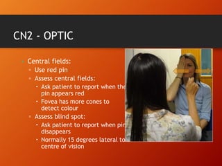 CN2 - OPTIC
• Central fields:
▫ Use red pin
▫ Assess central fields:
 Ask patient to report when the
pin appears red
 Fovea has more cones to
detect colour
▫ Assess blind spot:
 Ask patient to report when pin
disappears
 Normally 15 degrees lateral to
centre of vision
 