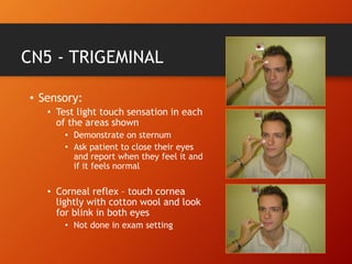 CN5 - TRIGEMINAL
• Sensory:
• Test light touch sensation in each
of the areas shown
• Demonstrate on sternum
• Ask patient to close their eyes
and report when they feel it and
if it feels normal
• Corneal reflex – touch cornea
lightly with cotton wool and look
for blink in both eyes
• Not done in exam setting
 