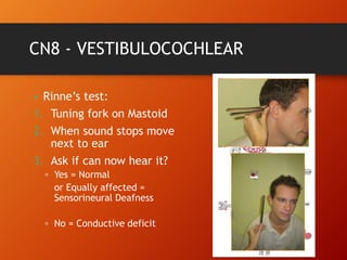 CN8 - VESTIBULOCOCHLEAR
• Rinne’s test:
1. Tuning fork on Mastoid
2. When sound stops move
next to ear
3. Ask if can now hear it?
▫ Yes = Normal
or Equally affected =
Sensorineural Deafness
▫ No = Conductive deficit
 