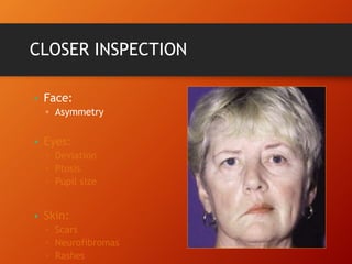 CLOSER INSPECTION
• Face:
▫ Asymmetry
•
•
 