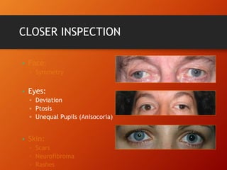 CLOSER INSPECTION
•
• Eyes:
▫ Deviation
▫ Ptosis
▫ Unequal Pupils (Anisocoria)
•
 