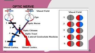 8
OPTIC NERVE
 
