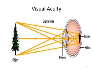Visual Acuity
10
 