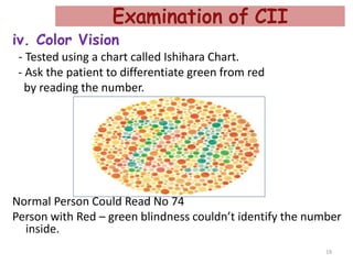 iv. Color Vision
- Tested using a chart called Ishihara Chart.
- Ask the patient to differentiate green from red
by reading the number.
Normal Person Could Read No 74
Person with Red – green blindness couldn’t identify the number
inside.
19
 