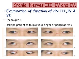 • Examination of function of CN III,IV &
VI
• Technique :-
- ask the patient to follow your finger or pencil as you
sweep through the six cardinal directions of gaze .
22
 