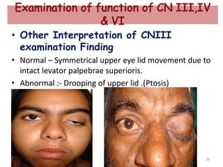 • Other Interpretation of CNIII
examination Finding
• Normal – Symmetrical upper eye lid movement due to
intact levator palpebrae superioris.
• Abnormal :- Drooping of upper lid .(Ptosis)
26
 