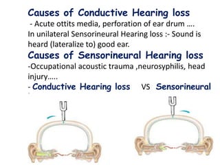 40
Causes of Conductive Hearing loss
- Acute ottits media, perforation of ear drum ….
In unilateral Sensorineural Hearing loss :- Sound is
heard (lateralize to) good ear.
Causes of Sensorineural Hearing loss
-Occupational acoustic trauma ,neurosyphilis, head
injury…..
- Conductive Hearing loss VS Sensorineural
loss
 
