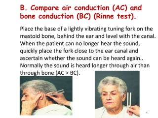 B. Compare air conduction (AC) and
bone conduction (BC) (Rinne test).
Place the base of a lightly vibrating tuning fork on the
mastoid bone, behind the ear and level with the canal.
When the patient can no longer hear the sound,
quickly place the fork close to the ear canal and
ascertain whether the sound can be heard again..
Normally the sound is heard longer through air than
through bone (AC > BC).
41
 