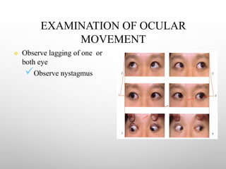 EXAMINATION OF OCULAR
MOVEMENT
v Observe lagging of one or
both eye
üObserve nystagmus
 