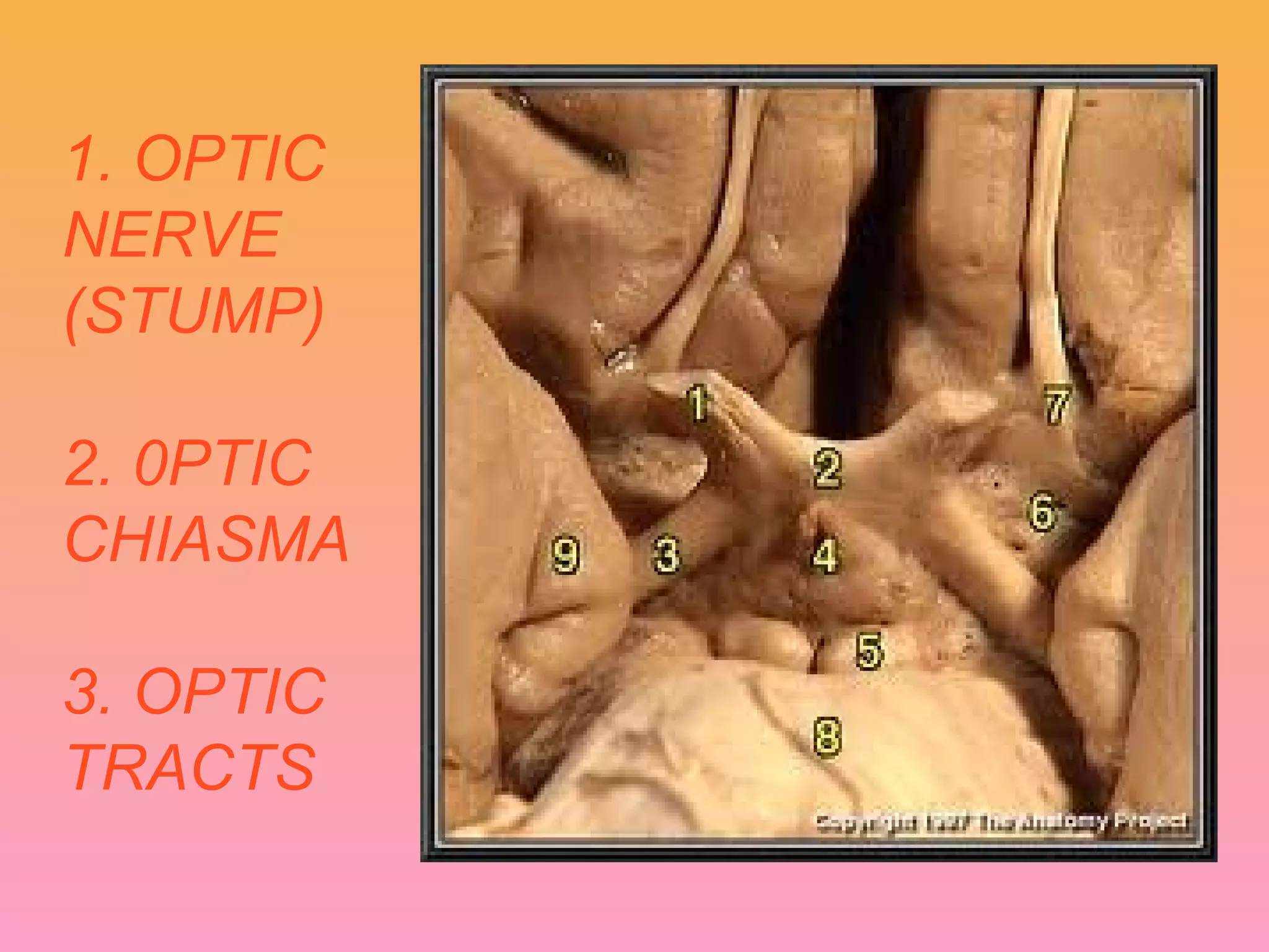 1. OPTIC
NERVE
(STUMP)
2. 0PTIC
CHIASMA
3. OPTIC
TRACTS
 