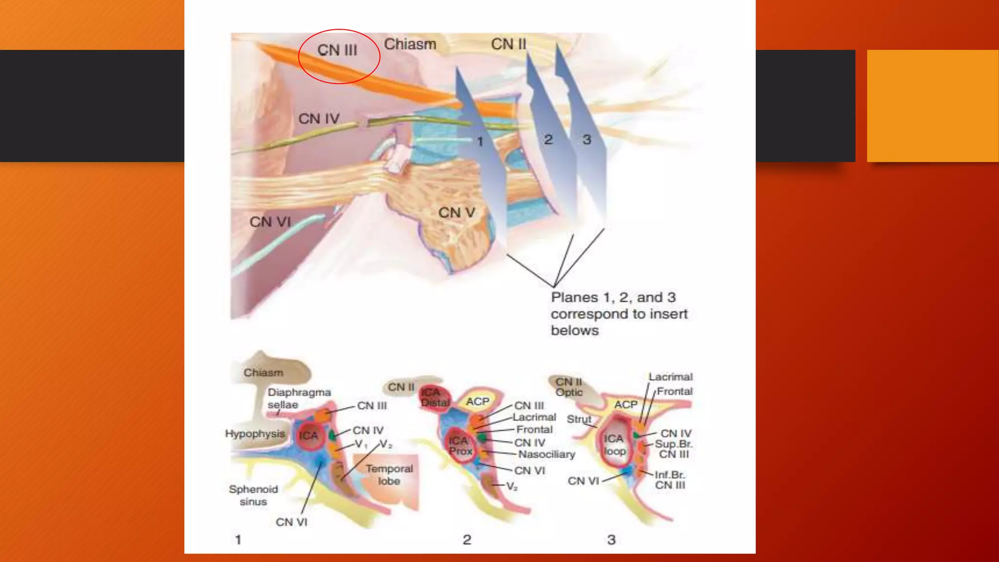 Cranial Nerve III, IV and VI Neuroanatomy.pptx