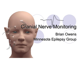 Cranial Nerve Monitoring Brian Owens Minnesota Epilepsy Group 