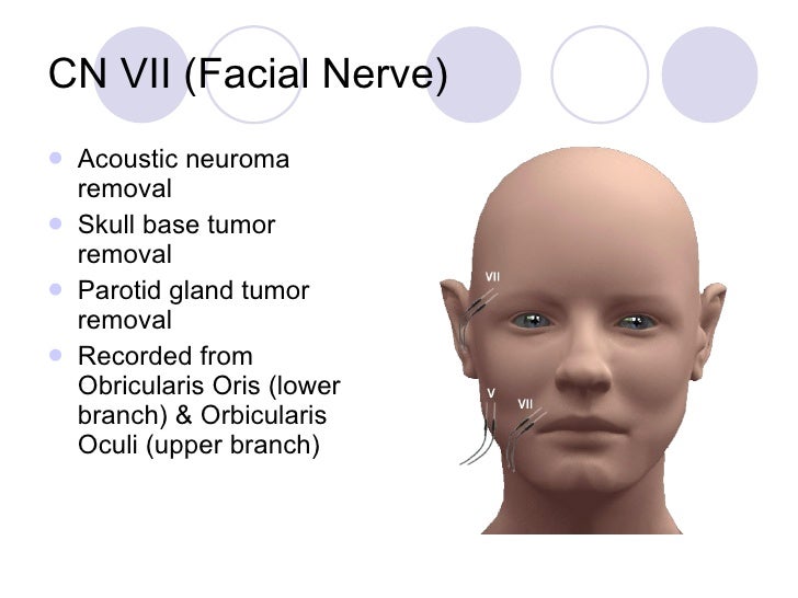 Facial Nerve Monitor 67