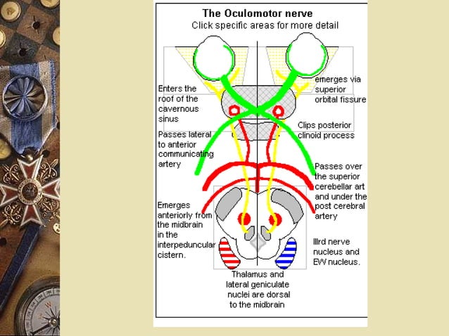 Cranial nerve palsies | PPT | Eye and Vision Conditions | Diseases and ...
