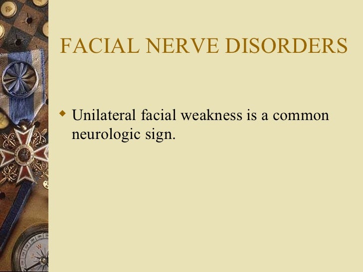 Facial Nerve Palsies 34