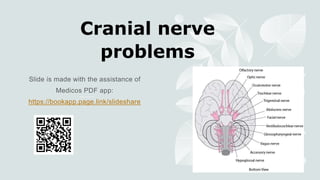 Cranial nerve
problems
https://bookapp.page.link/slideshare
 